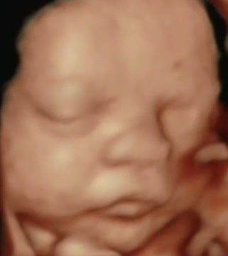 3D 4D Baby Prenatal Ultrasound Scan