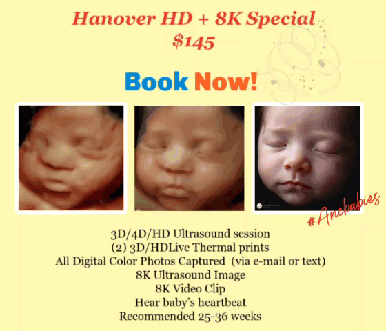 Hanover Special 8K Ultrasound Package