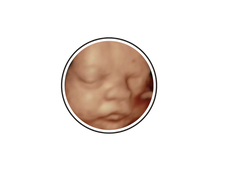 A New Conception 4D Ultrasound Studio
